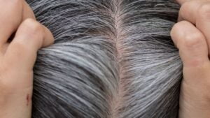 Home Remedies For White Hair